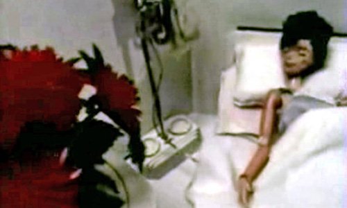 Doll in hospital bed in Superstar: The Karen Carpenter Story (1989)